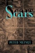 Scars